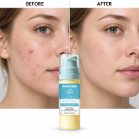 Crème Visage à l'Acide Salicylique pour Peaux à Tendance Acnéique, Anti-Imperfections, Anti-Marques de Boutons, Anti-Taches Brunes, Resserre les Pores et Contrôle le Sébum