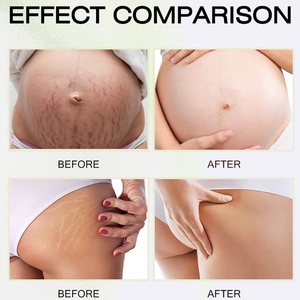 Crème corporelle hydratante de haute qualité <span class=keywords><strong>pour</strong></span> l'élimination des vergetures et <span class=keywords><strong>la</strong></span> réparation de <span class=keywords><strong>la</strong></span> peau <span class=keywords><strong>pour</strong></span> le traitement des cicatrices et <span class=keywords><strong>les</strong></span> soins du ventre de <span class=keywords><strong>la</strong></span> <span class=keywords><strong>grossesse</strong></span> - Product Image 4