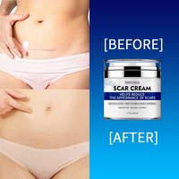 Crème Bio Puissante Contre les Cicatrices d'Acné, Vergetures, Boutons et Marques Abdominales