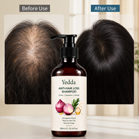 Shampoo anti-chute de cheveux naturel à l'oignon, sans sulfate, à base de squalane, pour la croissance des cheveux, en gros, marque privée OEM