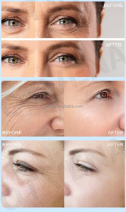 OTVENA — photo privée, lotion pour les yeux, élimination des poches, resserre <span class=keywords><strong>la</strong></span> peau, crème instantané, 60 secondes - Product Image 5