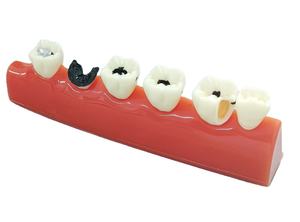 गाजर चित्रण विकास दंत दांत मॉडल - Product Image 3