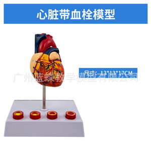 Modèle de cœur humain, modèle de cœur agrandi, modèle d'infarctus, modèle anatomique du cœur. - Product Image 1