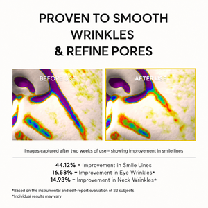 Crème Contour des Yeux Hydratante Anti-Poches et Anti-Rides à 2% de Rétinal et Caféine, 30ml, Marque Privée OEM ODM, Vente en Gros, Logo Personnalisé - Product Image 4