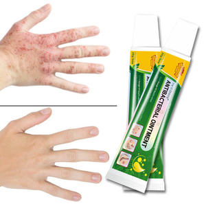 Özel Logo egzama krem yeşil sağlıklı cilt bakım kremi cilt kaşıntı merhem - Product Image 4