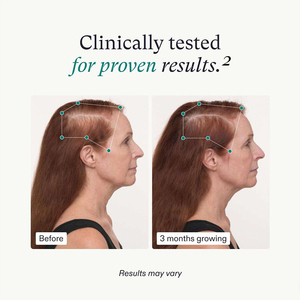 Kapsul penumbuh rambut pria, suplemen pertumbuhan rambut dan kulit kepala tebal - Product Image 2