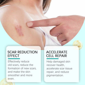 Laniska Spray d'élimination des cicatrices Formule douce Collagène Apaisant Hydratant Réparation Améliore <span class=keywords><strong>la</strong></span> qualité de <span class=keywords><strong>la</strong></span> peau - Product Image 2