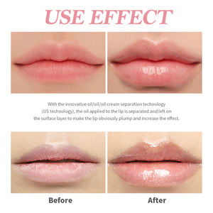 Booster Voluminizador de Labios con Efecto Picante, Gloss y Aceite para Labios Voluminosos Ultra Hidratante y Nutritivo - Product Image 6