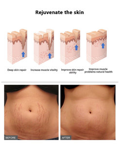 Crème <span class=keywords><strong>anti</strong></span>-vergetures pour <span class=keywords><strong>grossesse</strong></span> <span class=keywords><strong>anti</strong></span>-cicatrices réparation <span class=keywords><strong>efficace</strong></span> huile <span class=keywords><strong>anti</strong></span>-vergetures - Product Image 3