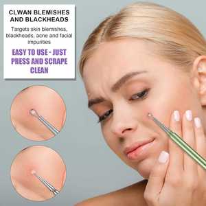Extracteur de points noirs professionnel en métal, double extrémité, aiguille durable <span class=keywords><strong>pour</strong></span> le nettoyage de l'acné, extracteur de points noirs et de boutons - Product Image 2