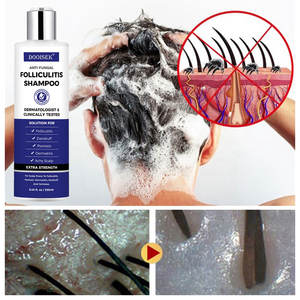 Champú de 250 ml para el Tratamiento de la <span class=keywords><strong>Dermatitis</strong></span> Seborreica, Anticaspa y Antipicazón, Alivia el Cuero Cabelludo Seco y con Picazón, Champú para la Foliculitis - Product Image 2