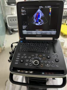 HM70A <b>Portable</b> <b>Ultrasound</b> <b>Machine</b> Competitive price ,worldwide shipping,5 Years warranty - Product Image 3