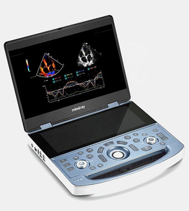 Mejor Precio de Máquina de Ultrasonido Doppler a Color Digital Portátil Mindray MX7 de Alta Calidad con Función Estable - Product Image 2