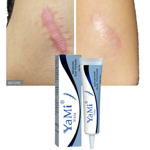 Crema para Eliminar Cicatrices Fuerte y Efectiva de Marca Privada para Cicatrices Antiguas en las Piernas, Gel para Marcas de Acné, Quemaduras y Estrías para Piel Dañada - Product Image 1