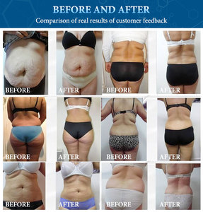 Presoterapia Corporal Profesional MaQuina De Drenaje LinfaTico 3 En 1 Con Crioterapia Avanzada - Product Image 5