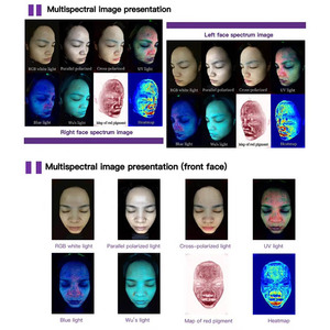 Analizzatore Cutaneo Portatile Serie Q2 a Prezzo di Fabbrica, Dispositivo per Analisi della Pelle del Viso per Uso Domestico con Logo Personalizzabile - Product Image 6