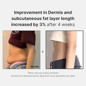 MEDICUBE AGE-R Contour Body Shot 140g Beauty Instrument Face & Neck Lifting <b>Massager</b> with EU Plug for Home Use Hot Selling - Product Image 3