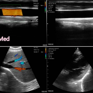 Échographe sans fil 3 en 1 à double tête 192 éléments, sonde d'échographie Doppler couleur intelligente DCU19G - Product Image 5
