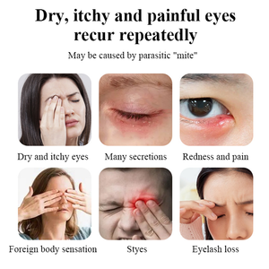 Toallitas limpiadoras en húmedo de embalaje individual de alta calidad OEM/ODM, toallitas para párpados para limpieza de párpados - Product Image 5