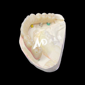 Pont Implantable Premium |   Base en titane avec couronne en céramique pour une restauration dentaire fiable | pour laboratoire ou clinique - Product Image 4