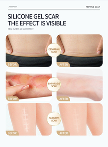 SHINECO Patch Cicatrisant en Silicone à la Vitamine pour la Récupération, <span class=keywords><strong>Anti</strong></span>-Cicatrices, Longue Durée, Usage Corporel, Vente en Gros - Product Image 4