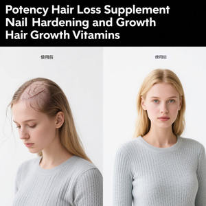 Sıvı biyotin potens saç dökülmesi takviyesi tırnak sertleştirme ve büyüme saç büyüme vitaminleri kollajen takviyesi düşer - Product Image 2