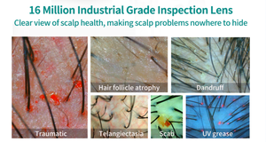15.6 inch 50x 200X ống kính phân tích da Máy sạc loại da đầu nang tóc Detector analyser thuận tiện tóc công cụ phân tích - Product Image 5