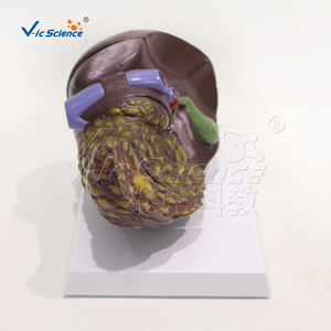 Modelo hepático doente (quatro estágios) hepatite crônica - Product Image 5