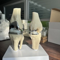 Zhizao 2026 Nouveau Modèle de Prothèse de Genou Articulée Amovible, Ensemble de Modèles d'Implant de Genou Double Argenté de Petite Taille