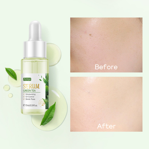 Fenyi 17ml Sérum Facial Anti-Acné au Thé Vert pour Contrôle du Sébum, Réduction des Pores et Réparation Cutanée à la Glycérine - Product Image 5