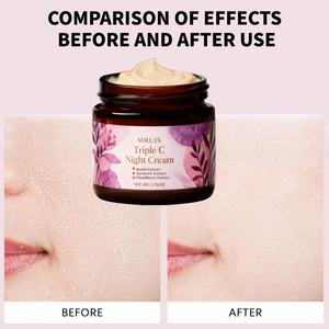 ครีมบำรุงผิวหน้าไพรเวทเลเบล 50 กรัม สูตรไตรพลังซี สำหรับกลางคืน ช่วยให้ผิวกระจ่างใส ลดเลือนริ้วรอย ด้วยวิตามินซี 3 รูปแบบ สำหรับผู้หญิง - Product Image 4