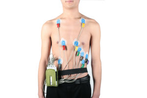 2024 Hete Producten Ce Goedgekeurd Chinese V & H Cv1200 Ecg Systeem Beste Elektrocardiogram Machine Metaal Plastic Elektroden Stresstest - Product Image 5