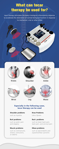 Máquina de <span class=keywords><strong>Diatermia</strong></span> de Onda Corta, Terapia Tecar, <span class=keywords><strong>Fisioterapia</strong></span>, Tratamiento del Dolor - Product Image 6