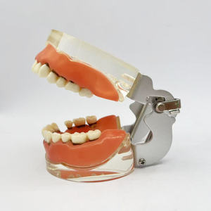 Parodontitis Model Medische Wetenschap Tandheelkundig Model Voor Opleiding In Scholen En Ziekenhuizen - Product Image 4