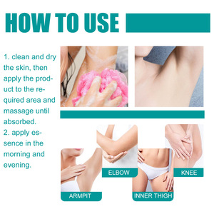 Cơ thể làm trắng kem nách đầu gối mông tư nhân tẩy loại bỏ melanin sắc tố cải thiện ngu si đần độn nuôi dưỡng làm sáng chăm sóc da - Product Image 3