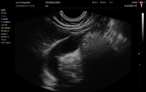 Ecógrafos Veterinarios 2D <span class=keywords><strong>3D</strong></span> Doppler a Color, <span class=keywords><strong>Precio</strong></span> <span class=keywords><strong>de</strong></span> Fábrica, Máquina <span class=keywords><strong>de</strong></span> Ultrasonido Veterinario Portátil - Product Image 3