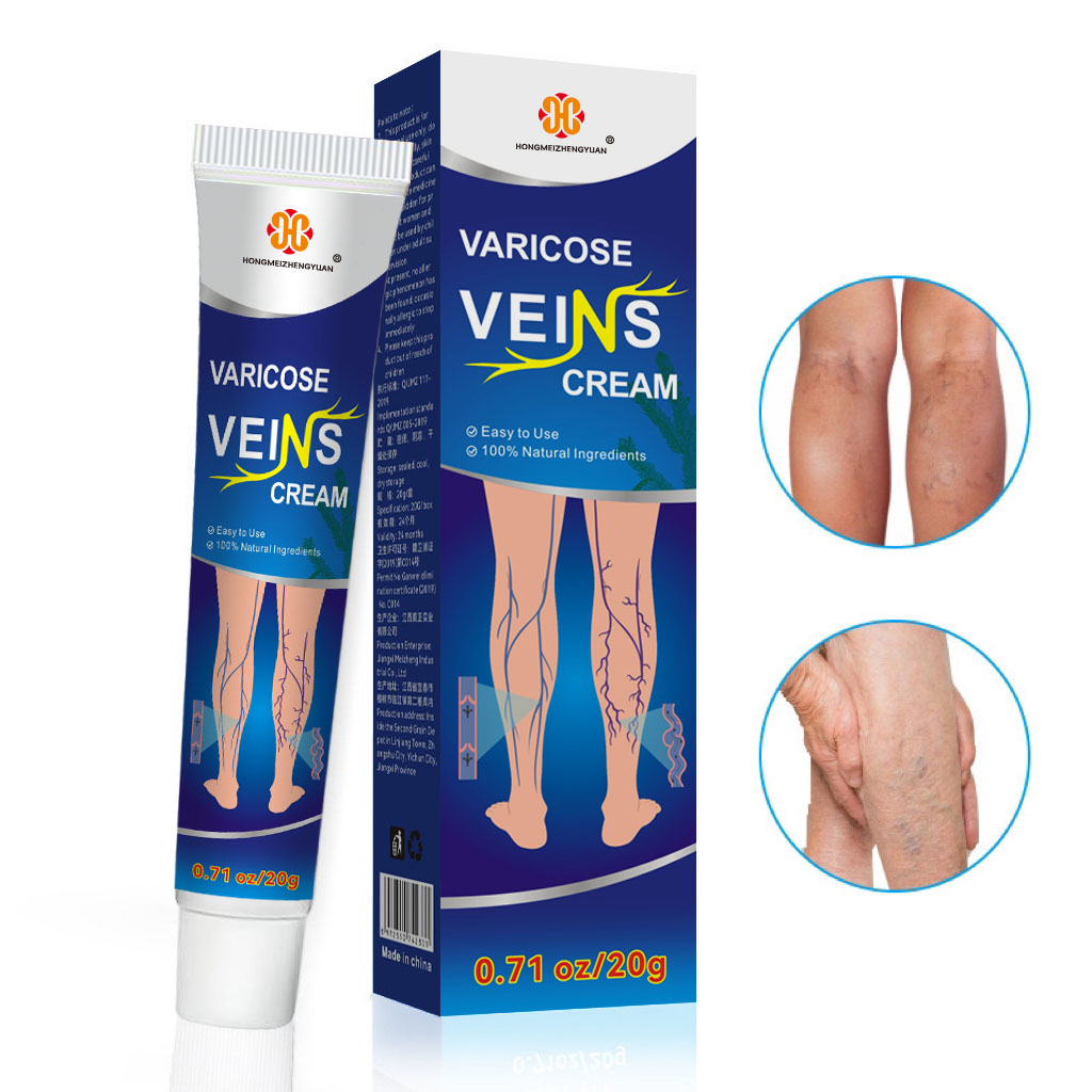 100% Original Varicose Vein Ointment for Vasculitis Earthworm Leg Pain Relief Ointment for Vasculitis Removal