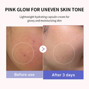 Cápsulas Liposomales Antienvejecimiento TIKTOK ODM/OEM Coreanas para Arrugas, 140 ml, PDRN, Crema Facial con Oro de 24k, Crema Hidratante Facial - Product Image 4