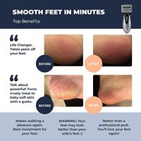 Dissolvant de callosités électrique, lime électronique rechargeable pour les pieds, meilleurs outils de pédicure, rouleaux, ponceuse professionnelle pour soins des pieds Pedi