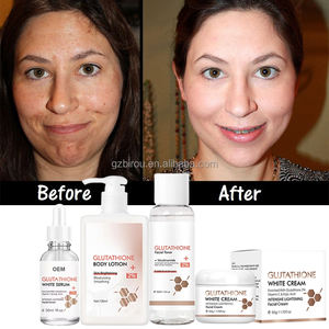 เซรั่มบำรุงผิวครีมทาหน้าฟอกสีขาวกลูตาเซรั่มบำรุงผิว - Product Image 1