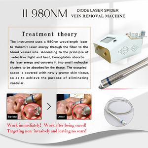 Máquina portátil de eliminación de venas varicosas con láser de diodo de 980nm para uso en salones de belleza - Product Image 3