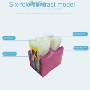 อุปกรณ์การสอนทางทันตกรรมแบบแมนนวลสำหรับการตรวจจับฟันผุ อุปกรณ์เสริมสำหรับการรักษาทางช่องปาก แบบจำลองขยาย 6 เท่าสำหรับการสอนเกี่ยวกับฟัน - Product Image 3