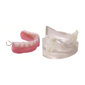 Dientes faltantes y <span class=keywords><strong>dentadura</strong></span> Modelo transparente Tamaño natural SMD035718 - Product Image 1