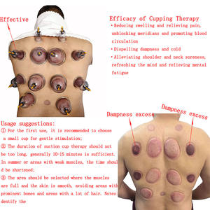 Set di 24 Coppette per Terapia Tradizionale Cinese, Metodo Fisico per Rilassare i Muscoli e Promuovere la Circolazione Sanguigna - Product Image 4