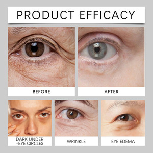 Crema de ojos para el cuidado de la piel, mezcla suave de hierbas, Bee Venom Lady, precio al por mayor, reduce las ojeras - Product Image 4