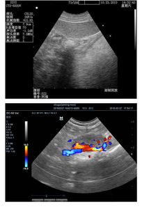 Scanner à ultrasons portable vétérinaire Machine à ultrasons portable Full Digital pour animaux avec CE - Product Image 2