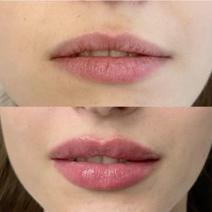 Gloss repulpant à l'acide hyaluronique, végan, hydratant, volumisant, maquillage pour les lèvres en marque privée - Product Image 6