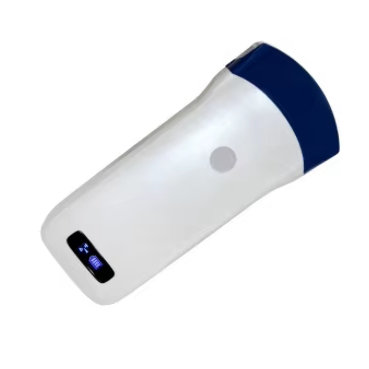 Portable Ultrasound Hospital Ultrasound Medical Ultrasound
