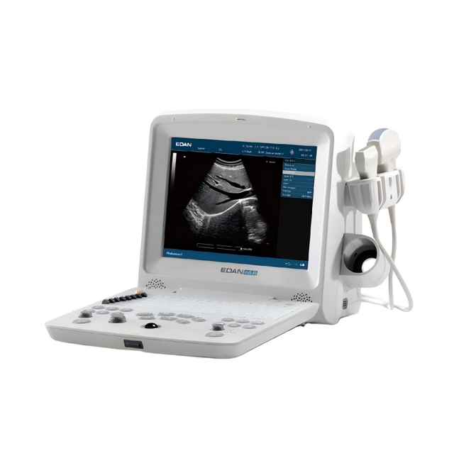 Edan Dus-60 Ultrasound Machine Laptop Edan Ultrasound Portable Ultrasound Machine