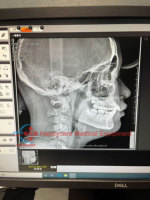 Appareil de radiographie panoramique dentaire électrique 3D PAPAYA Plus Pano Ceph CBCT d'occasion